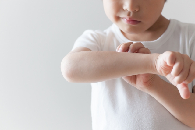 害虫駆除：蚊に刺されて腕を痒がる手男の子