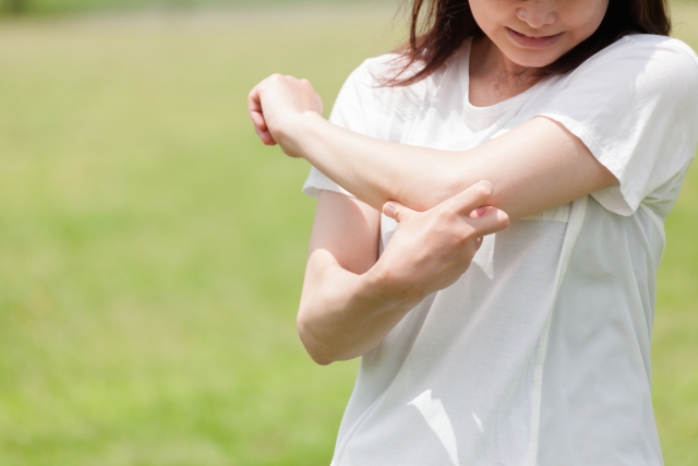 蚊の対策:蚊に刺されて痒がっている女性